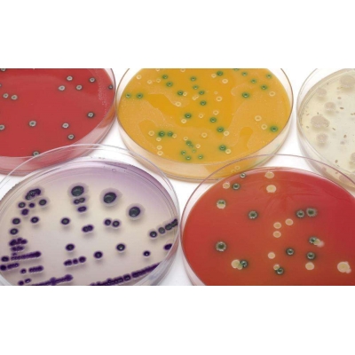 Бактериологические исследования (бак посев) — (клиники Di Центр)